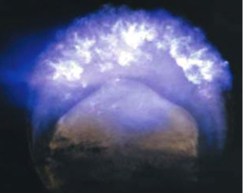Fireball of Operation Dominc Starfish Prime, 248 miles ( kilometers) above the Pacific Ocean, 9 July 1962. 